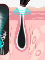 Aspirador Facial Visual Sorveil — Limpeza de Poros com Câmara Integrada