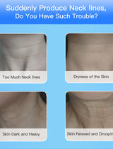 IPL Neck Pro Sorveil — Aparelho IPL com Iões Negativos para Rejuvenescimento e Firmeza do Pescoço